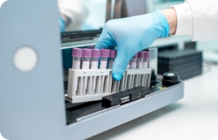 Stock image of laboratory assistant putting holder with test tubes into the analyser machine. Close-up view focused on the tubes.